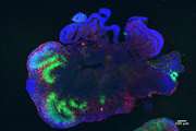 Organoid model systems are taking research to the next dimension