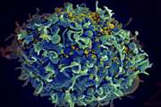 استفاده از سیستم CRISPR برای مبارزه با ویروس HIV