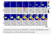 Novel label-free microscopy enables dynamic, high-resolution imaging of cell interactions