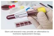 Scientists use stem cells to restore testosterone