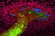 Human kidney progenitors isolated, offering new clues to cell renewal