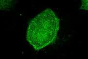 Purest yet, liver-like cells generated from induced pluripotent stem cells