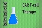 شاهدی دیگر بر ایمن و کاربردی بودن استفاده از سلول های CAR-T در درمان بیماران مبتلا به لوکمی