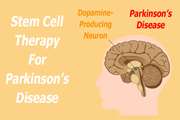 بهبود عملکرد سلول های عصبی میمون مبتلا به پارکینسون با استفاده از سلول های بنیادی القایی پرتوان