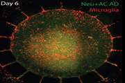 Microfluidic system incorporates neuroinflammation into "Alzheimer's in a dish" model