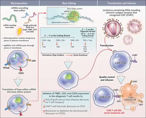 ژن‌درمانی انقلابی، مسیر درمان سرطان خون مقاوم را تغییر داد