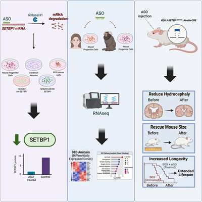 امیدی تازه برای درمان هیدروسفالی نوزادان با RNA‌درمانی